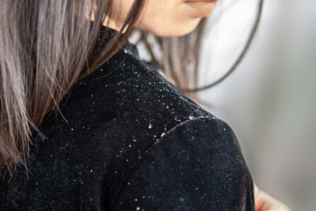 Dandruff and Eastern Medicine