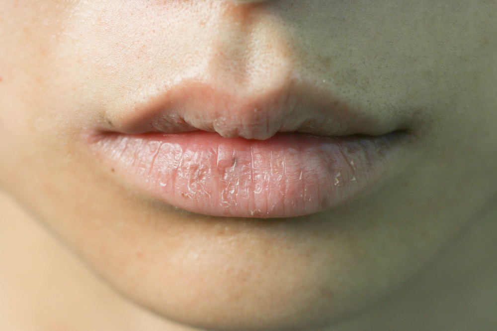 What your lips say about your health in eastern medicine