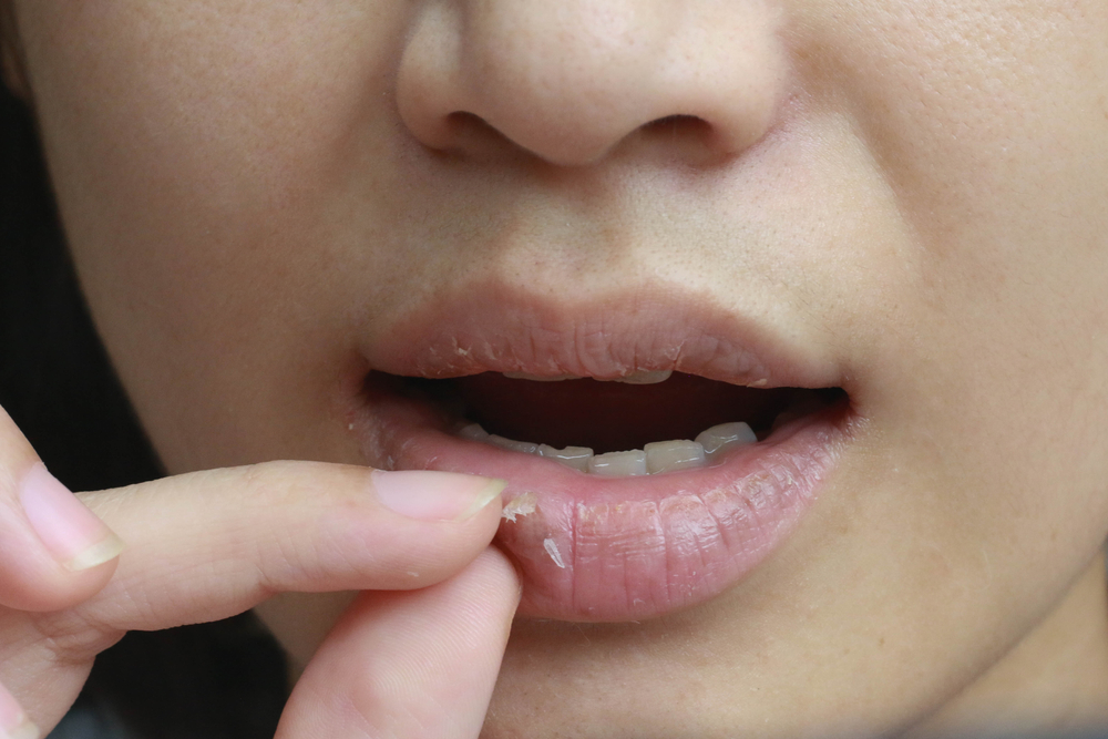 What your lips say about your health in eastern medicine