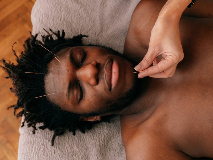 Why Acupuncture Is On The Rise